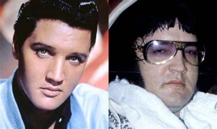 
Elvis Presley Obituary, What was Elvis Presley Cause of Death? 